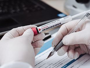 coronavirus-in-sicilia-al-via-i-test-sierologici-ecco-chi-ne-ha-diritto-e-con-quali-procedure