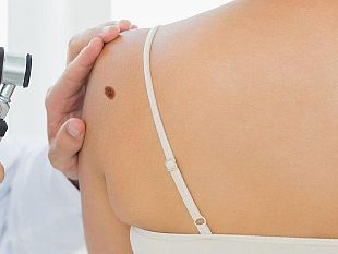 trapani-incontro-su-skin-cancer-il-melanoma-fa-meno-paura