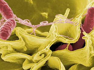 salmonella-nellacqua-potabile-emergenza-nei-comuni-del-belice