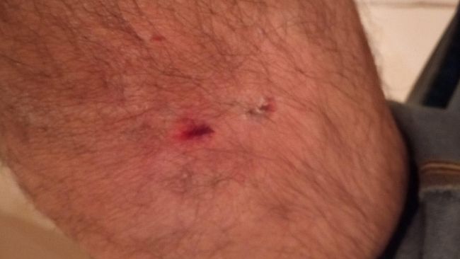 Marsala: uomo aggredito da un branco di cani randagi in via Frisella