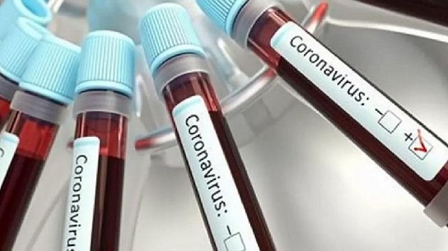 Coronavirus, sale a 292 il numero dei casi in provincia di Trapani