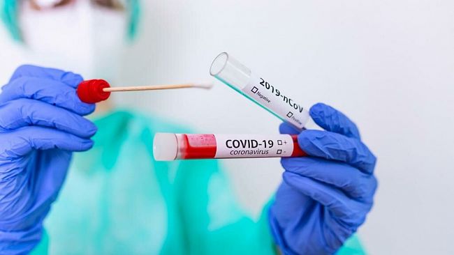 Covid-19, i positivi in provincia sono 4.208. Registrati tre nuovi decessi