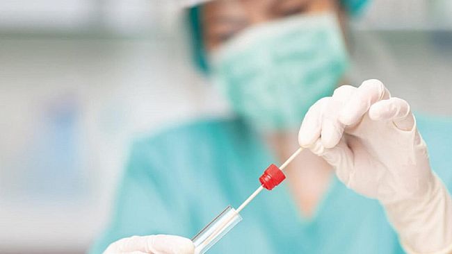 Covid19, domani giornata di screening gratuiti presso la sede della Croce Rossa di Castelvetrano