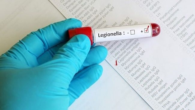 Trapani, due stanze di albergo chiuse per legionella