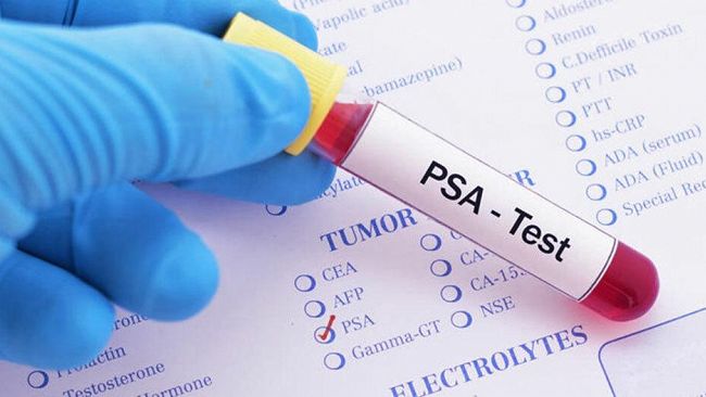 Asp Trapani, prima in Sicilia per l’esecuzione dei test per carcinoma prostatico