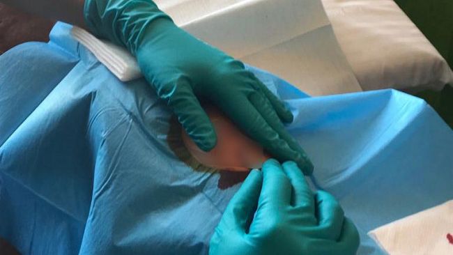 Diabete: Oggi primi controlli dell’eversense all’ospedale di Mazara