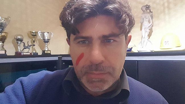 Il 25 novembre Giornata Internazionale contro la violenza sulle donne, ancora molto da fare…  
