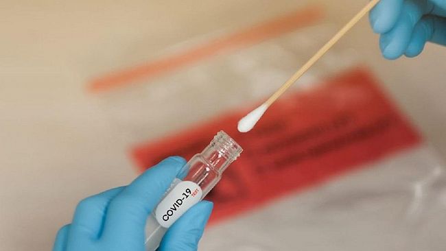 Covid 19,  screening gratuiti in dieci città della provincia. Ecco i risultati