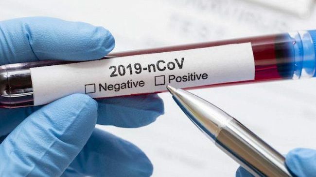 Covid, riapre alla Cittadella della Salute il laboratorio tamponi per esterni